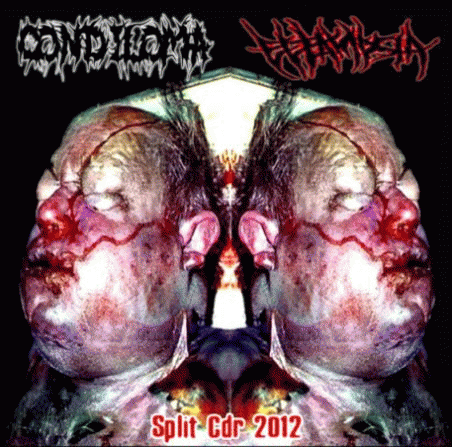 Condiloma : Condiloma - Eclampsia Condiloma : Condiloma - Eclampsia